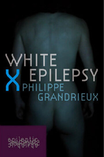 Белая эпилепсия (2012)